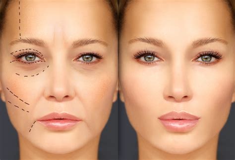 Plastic Surgery .